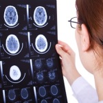 traumatic brain injury