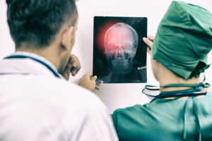 Personal injury is a leading cause of traumatic brain injuries.