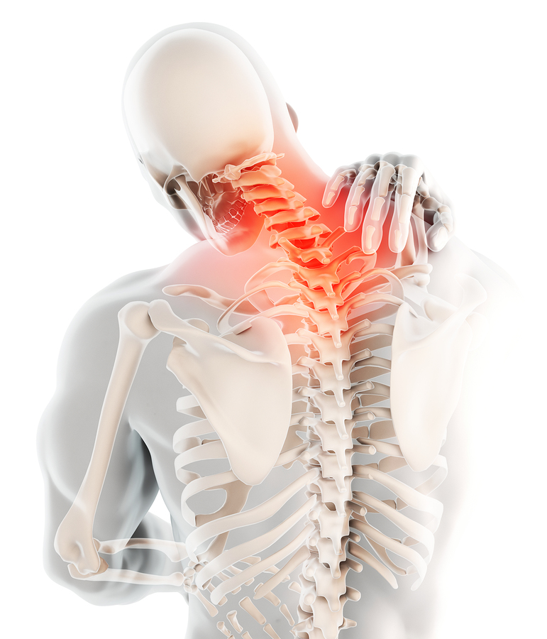 3d Illustration, Neck Painful – Cervical Spine Skeleton X-ray, M