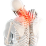 3d Illustration, Neck Painful - Cervical Spine Skeleton X-ray, M