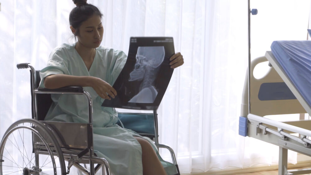 woman holding x ray