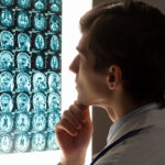 brain surgeon looking at x-rays