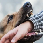 What Are Signs of Nerve Damage After Dog Bites in SoCal?