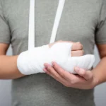 How Do Negligent Trees Cause Injuries in San Diego?